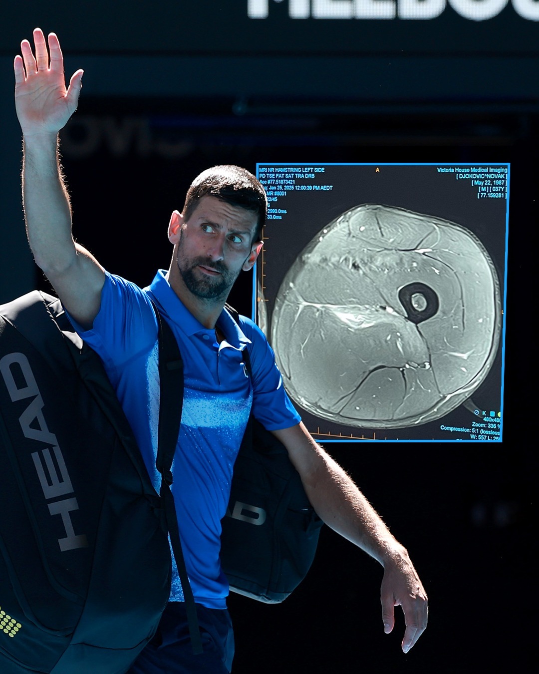 澳网险胜联合杯，德约科维奇高光表现的简单介绍